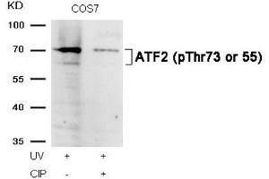 Western Blotting (WB) image for anti-Activating Transcription Factor 2 (ATF2) (pThr73) antibody (ABIN7138878)