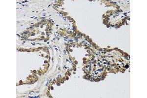 Immunohistochemistry of paraffin-embedded Human prostate using IL25 Polyclonal Antibody at dilution of 1:100 (40x lens). (IL-25 抗体)