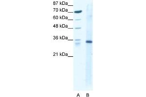 WB Suggested Anti-KLF3 Antibody Titration:  1. (KLF3 抗体  (N-Term))