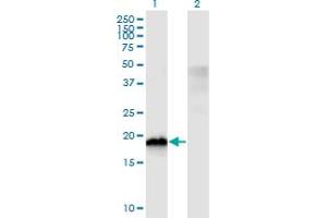 Western Blot analysis of CIRBP expression in transfected 293T cell line by CIRBP monoclonal antibody (M03), clone 1C9. (CIRBP 抗体  (AA 1-90))