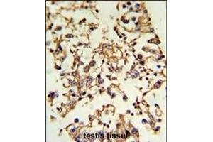 Formalin-fixed and paraffin-embedded human testis tissue reacted with PRKACA Antibody (N-term K82), which was peroxidase-conjugated to the secondary antibody, followed by DAB staining. (PRKACA 抗体  (N-Term))