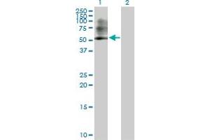 Western Blot analysis of PSMC3 expression in transfected 293T cell line by PSMC3 MaxPab polyclonal antibody. (PSMC3 抗体  (AA 1-439))
