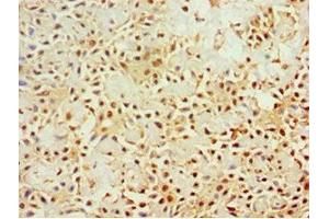 Immunohistochemistry (IHC) image for anti-Killer Cell Lectin-Like Receptor Subfamily C, Member 1 (KLRC1) (AA 114-233) antibody (ABIN7161640)