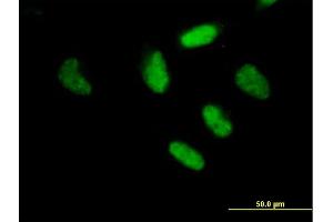 Immunofluorescence of purified MaxPab antibody to RFX3 on HeLa cell. (RFX3 抗体  (AA 1-749))