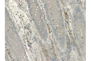 ABIN6256669 and ABIN6267133 at 1/100 staining human normal colon tissue by IHC-P. (LAT 抗体  (pTyr200))