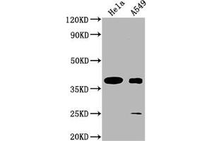 Western Blot Positive WB detected in: Hela whole cell lysate, A549 whole cell lysate All lanes: TAS2R7 antibody at 1:2000 Secondary Goat polyclonal to rabbit IgG at 1/50000 dilution Predicted band size: 37 kDa Observed band size: 37 kDa (TAS2R7 抗体  (AA 151-168))