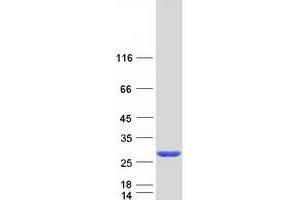 Validation with Western Blot