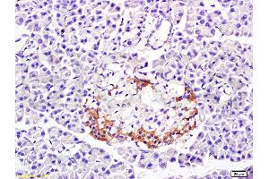 Immunohistochemistry (IHC) image for anti-Protein Phosphatase 1, Catalytic Subunit, beta Isoform (PPP1CB) (AA 155-250) antibody (ABIN725465)