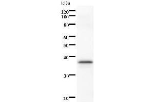 Western Blotting (WB) image for anti-serine/threonine Kinase 3 (STK3) antibody (ABIN933165) (STK3 抗体)