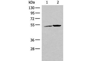 Western blot analysis of K562 cell and Human heart tissue lysates using FECH Polyclonal Antibody at dilution of 1:500 (FECH 抗体)