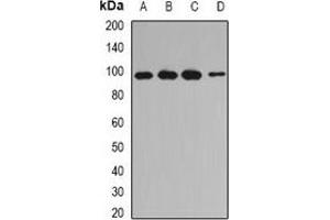 Western blot analysis of INPP4A expression in Jurkat (A), MCF7 (B), mouse testis (C), rat skeletal muscle (D) whole cell lysates.
