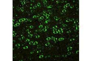 Anti-ABI1 antibody, IHC(P): Rat Brain Tissue (ABI1 抗体  (C-Term))