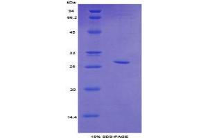 SDS-PAGE analysis of Mouse Topoisomerase II beta Protein. (TOP2B 蛋白)