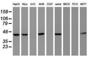 Image no. 3 for anti-Chromobox Homolog 8 (CBX8) (AA 1-260) antibody (ABIN1490660) (CBX8 抗体  (AA 1-260))