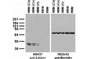 Immunoblot against crude membrane fractions from whole rat (RBM) or mouse (MBM) brain and from human hippocampus [HBM(H)], cerebral cortex [HBM(Cx)] or cerebellum [HBM(Cb)] probed with N84/37 (left) or N52A/42 (right) TC supe.