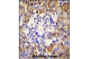 PRDX4 Antibody (Center) (ABIN656035 and ABIN2845408) immunohistochemistry analysis in formalin fixed and paraffin embedded human pancreas tissue followed by peroxidase conjugation of the secondary antibody and DAB staining. (Peroxiredoxin 4 抗体  (AA 82-110))