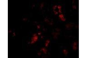 Immunofluorescence of BANF1 in human kidney tissue with AP30118PU-N BANF1 antibody at 20 μg/ml. (BANF1 抗体  (C-Term))