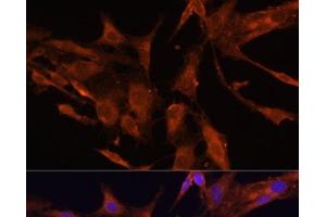 Immunofluorescence analysis of C6 cells using RECK Polyclonal Antibody at dilution of 1:100 (40x lens). (RECK 抗体)