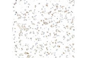 anti-Oxidized Low Density Lipoprotein (Lectin-Like) Receptor 1 (OLR1) (AA 61-273) antibody