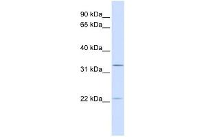 BRI3BP antibody used at 1 ug/ml to detect target protein. (BRI3BP 抗体  (C-Term))