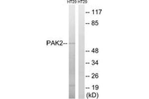 Western blot analysis of extracts from HT-29 cells, using PAK2 (Ab-197) Antibody.