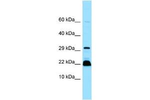 WB Suggested Anti-MYLPF Antibody Titration: 1. (MYLPF 抗体  (C-Term))