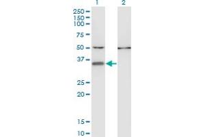Western Blot analysis of CENPV expression in transfected 293T cell line by CENPV monoclonal antibody (M05), clone 1D9. (CENPV 抗体  (AA 173-272))