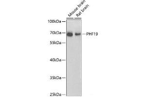 Western blot analysis of extracts of various cell lines using PHF19 Polyclonal Antibody at dilution of 1:1000. (PHF19 抗体)