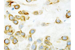 Anti-Thrombospondin 2 antibody, IHC(P) IHC(P): Human Placenta Tissue (Thrombospondin 2 抗体  (Middle Region))