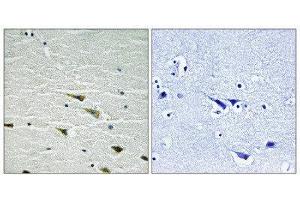 Immunohistochemistry (IHC) image for anti-Neurotrophic Tyrosine Kinase, Receptor, Type 1 (NTRK1) (pTyr757) antibody (ABIN1847659) (TRKA 抗体  (pTyr757))