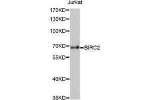 Western blot analysis of extracts of Jurkat cells, using BIRC2 antibody (ABIN5970373) at 1/1000 dilution. (BIRC2 抗体)