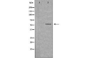 Western blot analysis of extracts from K562 cells, using ZSCAN22 antibody. (ZSCAN22 抗体  (Internal Region))