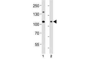 Western Blotting (WB) image for anti-DNA (Cytosine-5-)-Methyltransferase 3 alpha (DNMT3A) (AA 463-497) antibody (ABIN3030748)