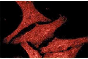 Immunofluorescence staining of human fibroblast cells stained with the mouse anti-Casein Kinase Iepsilon antibody. (CK1 epsilon 抗体  (AA 248-414))