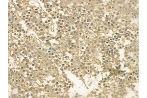 anti-Kinesin Family Member 12 (KIF12) (N-Term) antibody