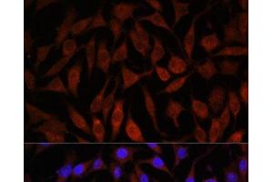 Immunofluorescence analysis of L929 cells using NEDD4L Polyclonal Antibody at dilution of 1:100. (NEDD4-2 抗体)
