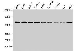 Western Blot Positive WB detected in: Hela whole cell lysate, K562 whole cell lysate, MCF-7 whole cell lysate, Jurkat whole cell lysate, A375 whole cell lysate, SH-SY5Y whole cell lysate, HepG2 whole cell lysate, U87 whole cell lysate, HL60 whole cell lysate All lanes: NOP58 antibody at 1:2000 Secondary Goat polyclonal to rabbit IgG at 1/50000 dilution Predicted band size: 60 kDa Observed band size: 60 kDa (NOP58 抗体  (AA 1-529))