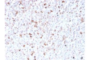 Formalin-fixed, paraffin-embedded human spleen stained with Lambda Light Chain Recombinant Rabbit Monoclonal Antibody (LLC/3778R). (Recombinant IgL 抗体)