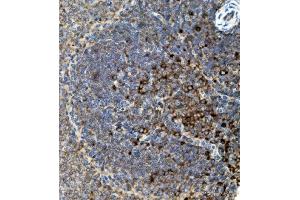 IHC analysis of CD74 using anti-CD74 antibody (ABIN7603166). (CD74 抗体  (N-Term))