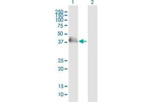 Western Blot analysis of HEL308 expression in transfected 293T cell line ( H00113510-T01 ) by HEL308 MaxPab polyclonal antibody. (HEL308 抗体  (AA 1-272))