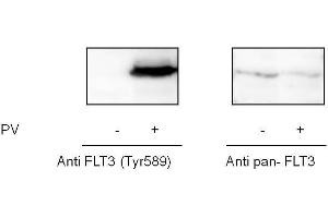 FLT3 ELISA 试剂盒