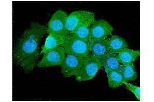 IF analysis of Beta 2 Microglobulin using anti-Beta 2 Microglobulin antibody (ABIN6719452). (beta-2 Microglobulin 抗体  (AA 22-119))