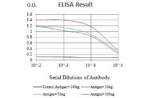 Black line: Control Antigen (100 ng),Purple line: Antigen (10 ng), Blue line: Antigen (50 ng), Red line:Antigen (100 ng) (Topoisomerase II alpha 抗体  (AA 1100-1530))