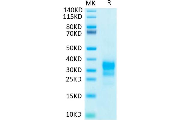 Interferon gamma Protein (IFNG) (His-Avi Tag,Biotin)