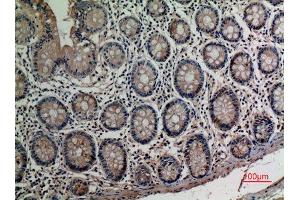 Immunohistochemistry (IHC) analysis of paraffin-embedded Human Colon, antibody was diluted at 1:100. (AAT (Internal Region) 抗体)