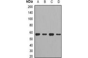 Western blot analysis of CCT2 expression in A549 (A), HT29 (B), mouse spleen (C), mouse heart (D) whole cell lysates. (CCT2 抗体)