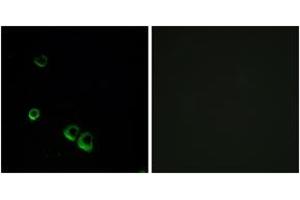 Immunofluorescence analysis of MCF7 cells, using AVPR2 Antibody. (AVPR2 抗体  (AA 72-121))