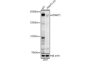 Western blot analysis of extracts from wild type (WT) and DNMT1 knockdown (KD) 293T cells, using DNMT1 antibody (ABIN7266808) at 1:1000 dilution. (DNMT1 抗体)
