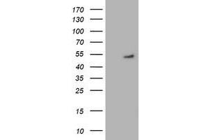 HEK293T cells were transfected with the pCMV6-ENTRY control (Left lane) or pCMV6-ENTRY GSS (Right lane) cDNA for 48 hrs and lysed. (Glutathione Synthetase 抗体)