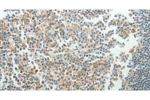 Immunohistochemistry of paraffin-embedded Human tonsil using NDRG3 Polyclonal Antibody at dilution of 1:70 (NDRG3 抗体)